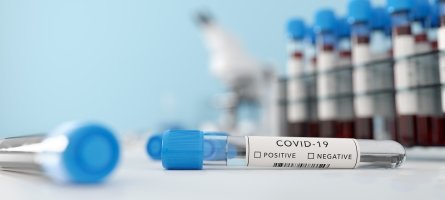 COVID 19 test vials
